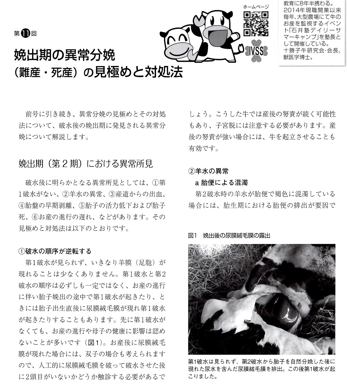 異常分娩